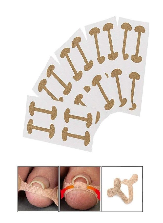 EBANKU Ingrown Toenail Treatment Strips, 20 Pcs Toe Nail Correction Patch Elastic Patch Sticker Corrector Pedicure Tools Fingernail Toe Nail Care - Image 1